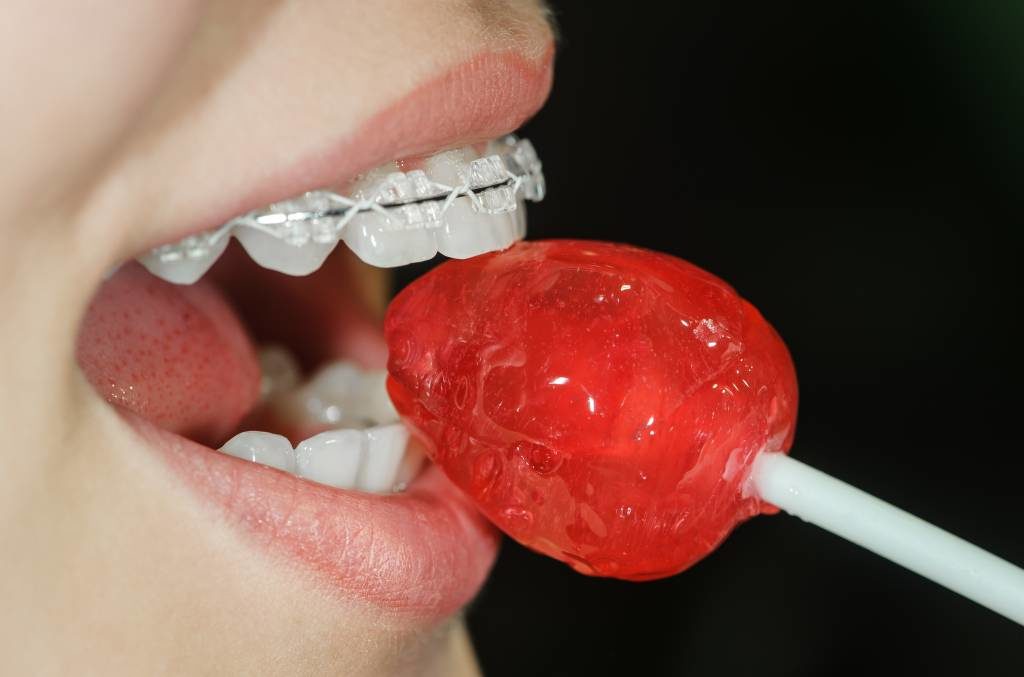 לעיסה של מזון קשה יכול ליצור מצב חירום רפואי בשיניים