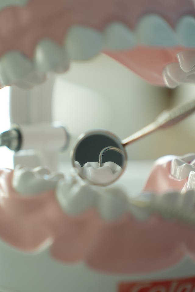 שיקום הפה למעשנים: אילו אפשרויות קיימות וכיצד העישון משפיע על התוצאה?