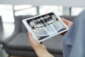 שיקום הפה עם פתרונות ניידים: טיפולים מהירים בזמן קצר